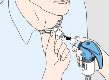 Inhalación con traqueotomía ¿Qué dispositivo para qué paciente - Medical M&B