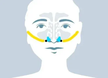 Solución salina hipertónica para niños y bebés - Medical M&B